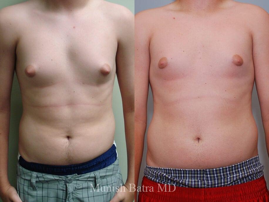 Before and After Image