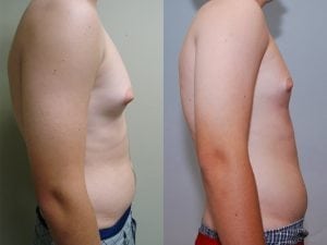 Before and After Image