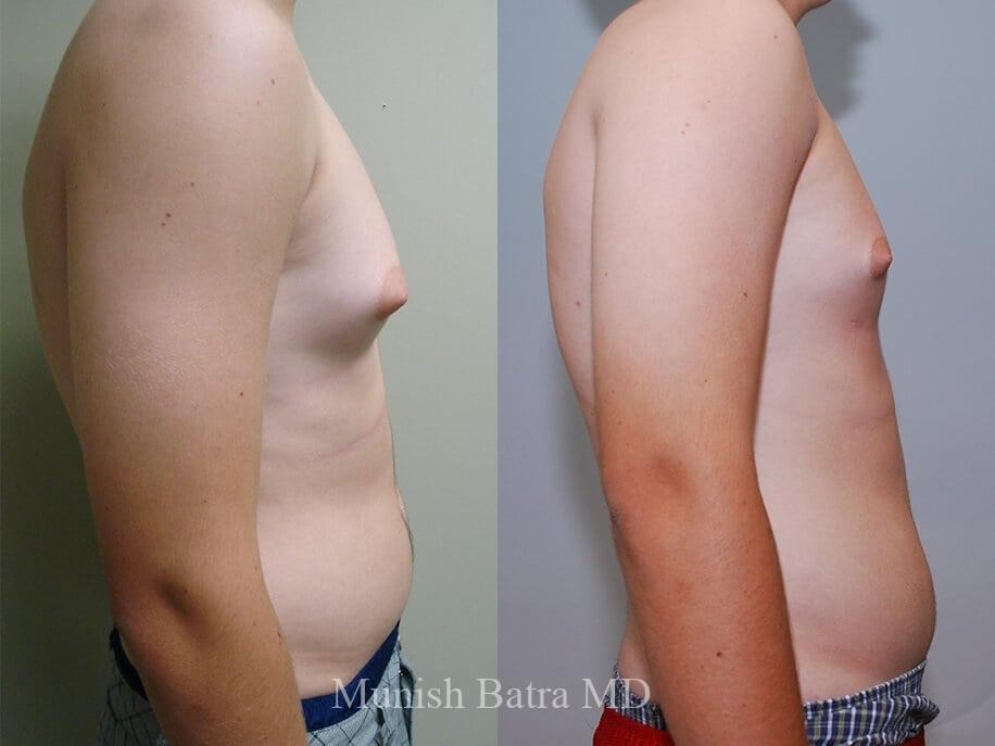 Before and After Image