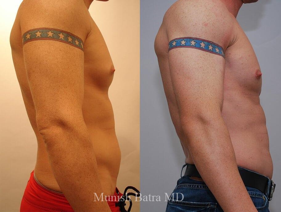 Before and After Image