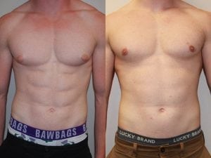Before and After Image