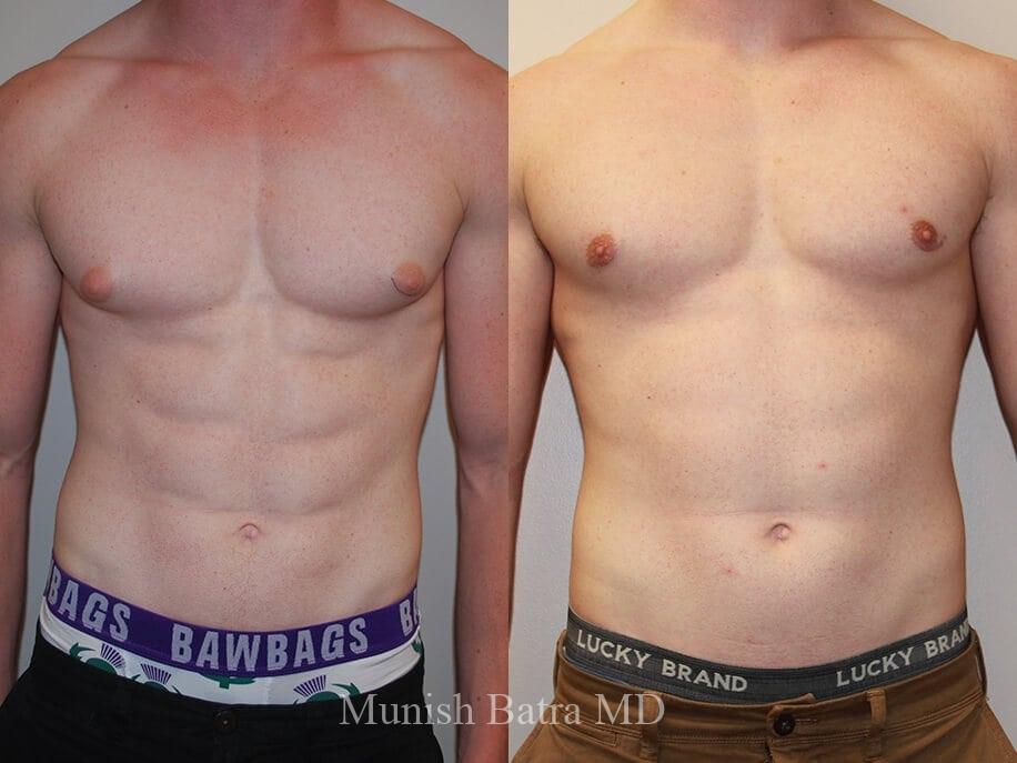 Before and After Image
