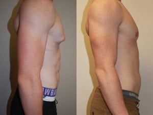 Before and After Image