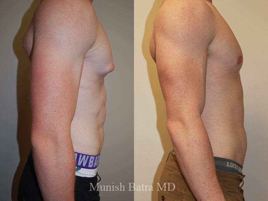 Before and After Image