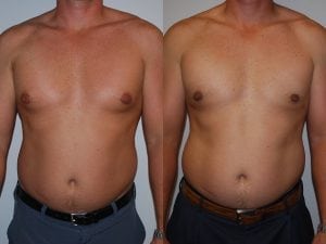 Before and After Image