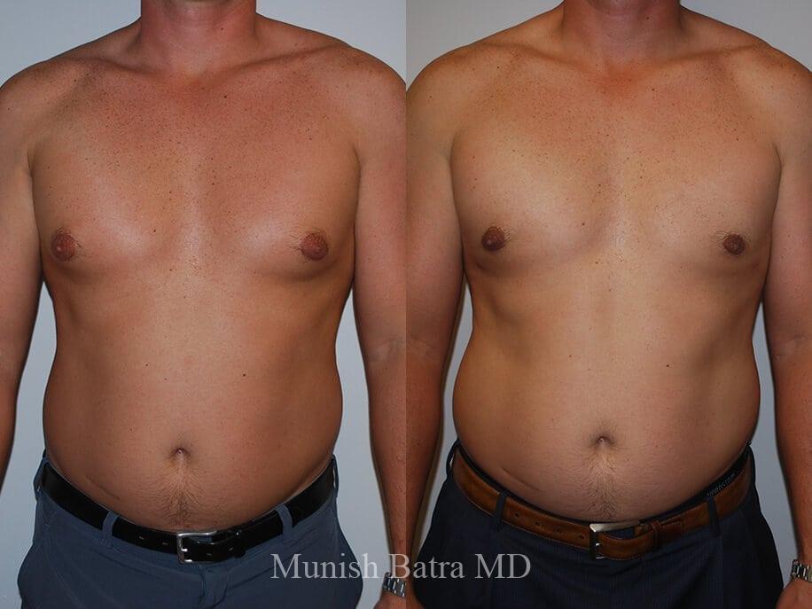Before and After Image