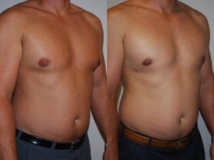 Before and After Image