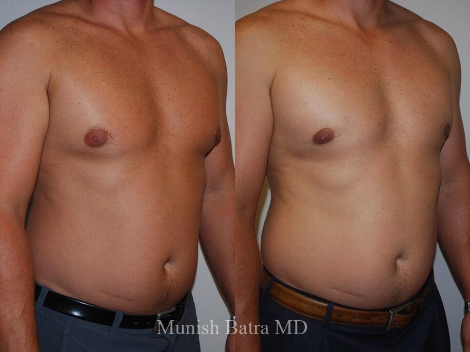 Before and After Image