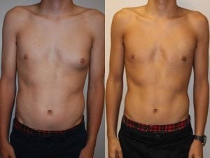 Before and After Image