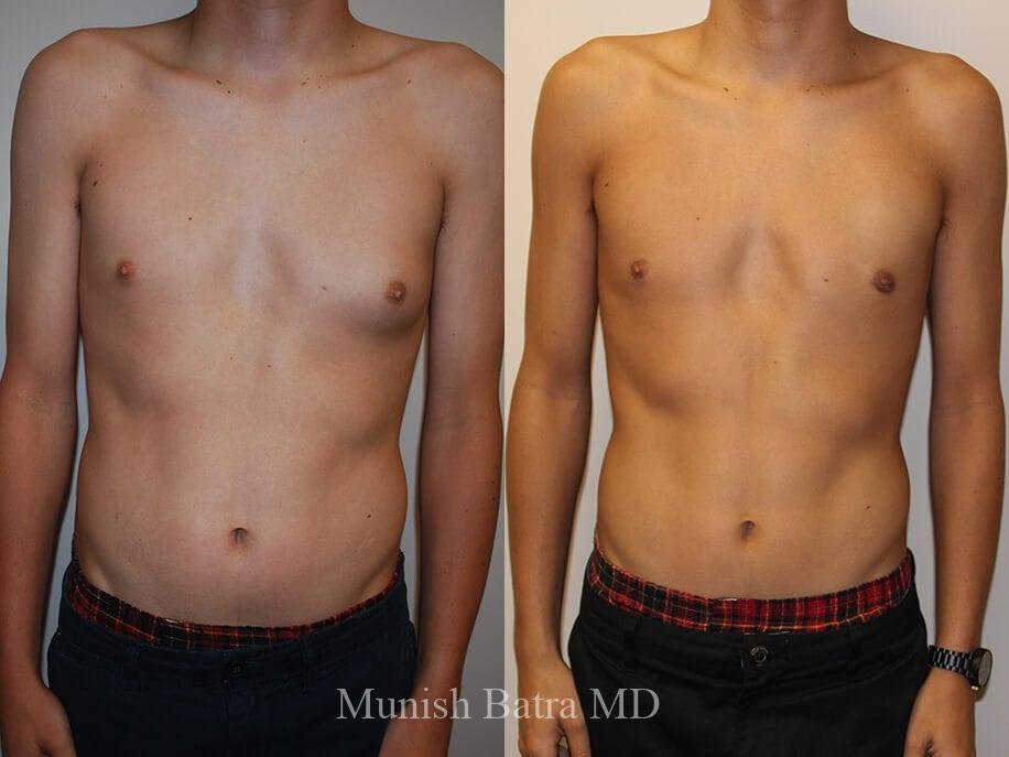 Before and After Image
