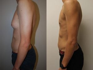 Before and After Image