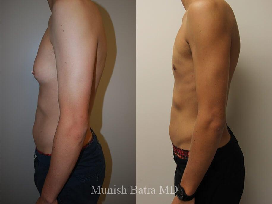 Before and After Image