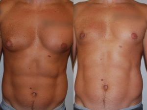 Before and After Image