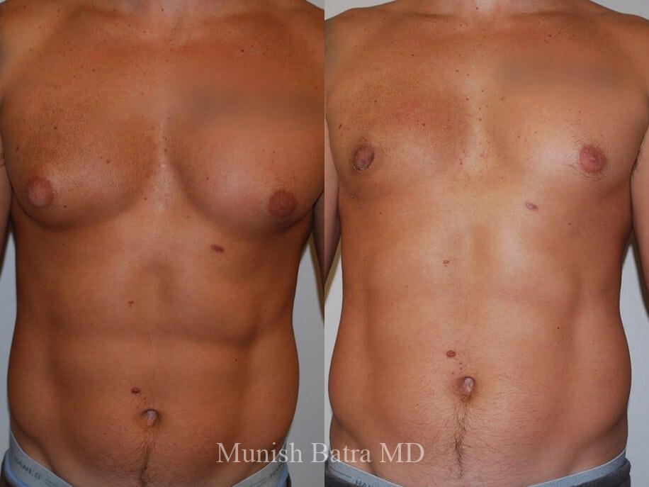 Before and After Image
