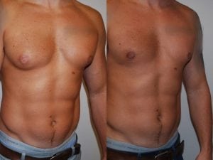 Before and After Image