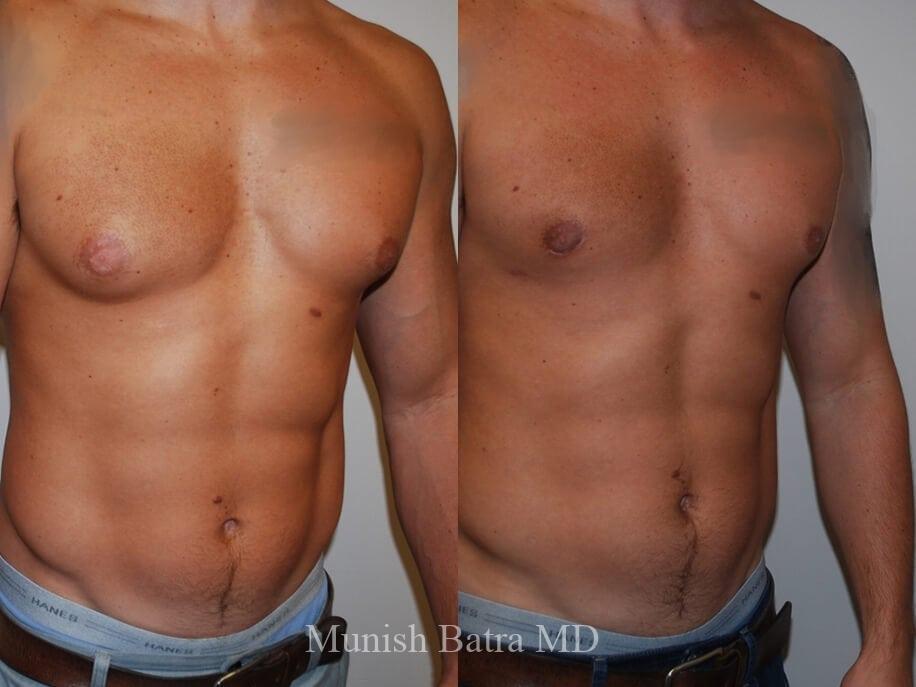 Before and After Image