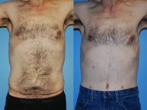 Before and After Image