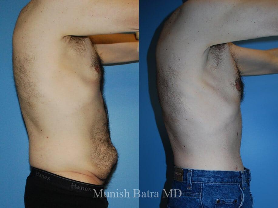 Before and After Image