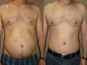 Before and After Image