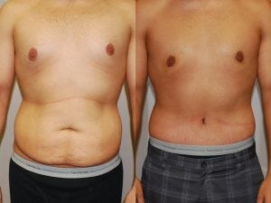 Before and After Image