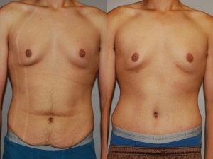 Before and After Image
