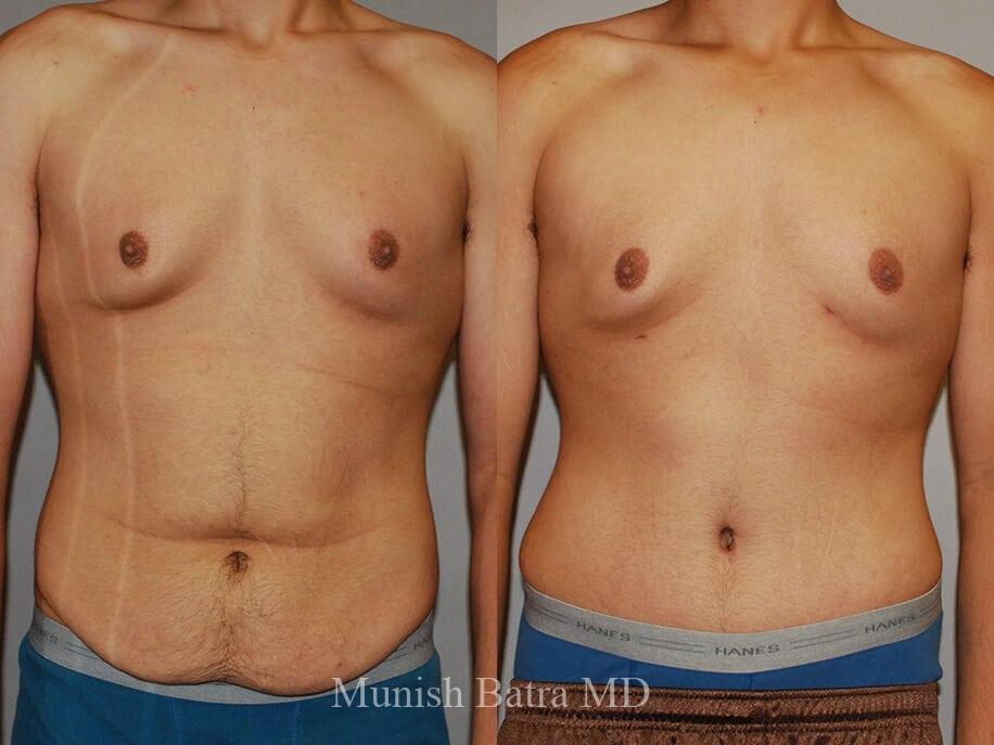Before and After Image