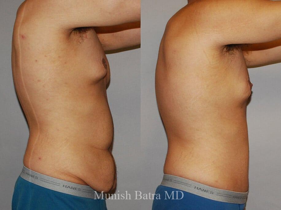 Before and After Image