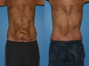 Before and After Image