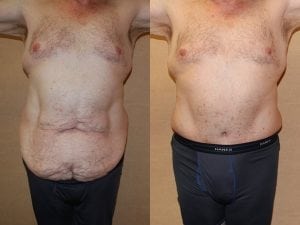 Before and After Image