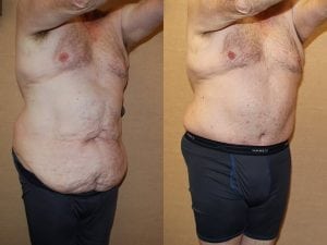 Before and After Image