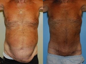 Before and After Image