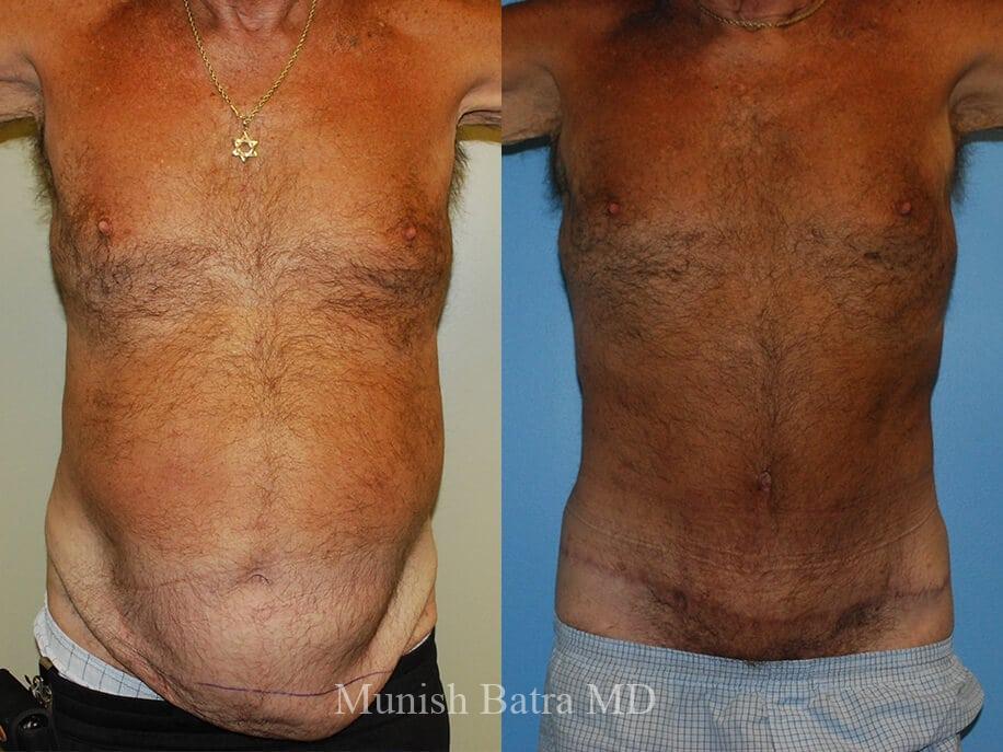 Before and After Image