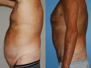 Before and After Image