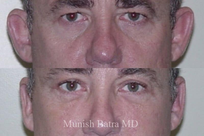 Before and After Image