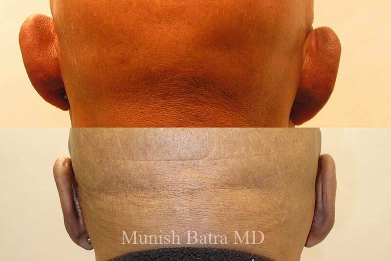 Before and After Image