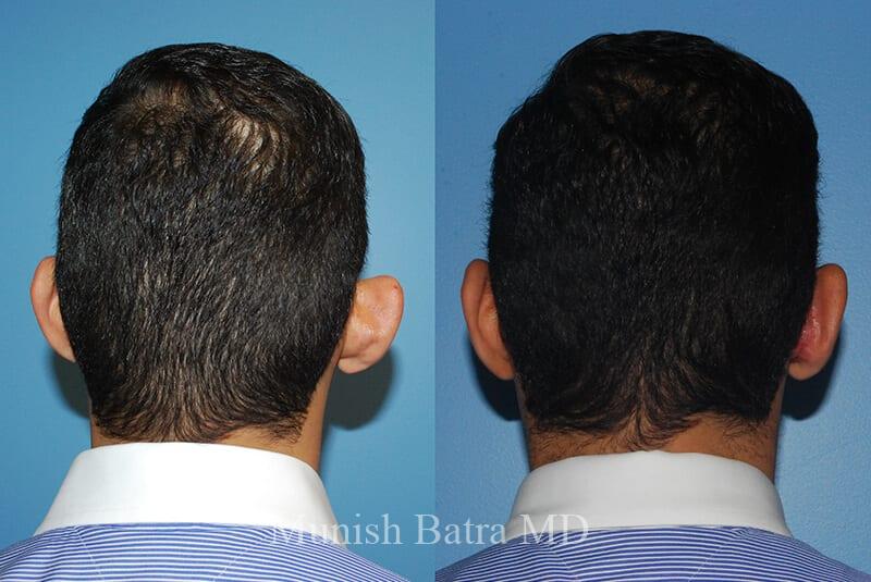 Before and After Image