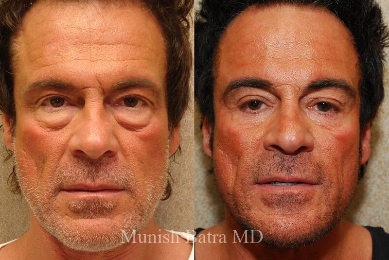 Before and After Image