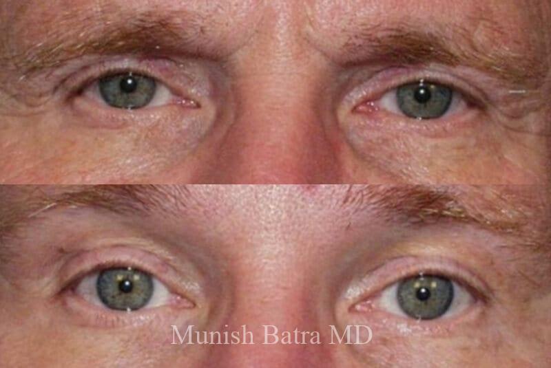 Before and After Image