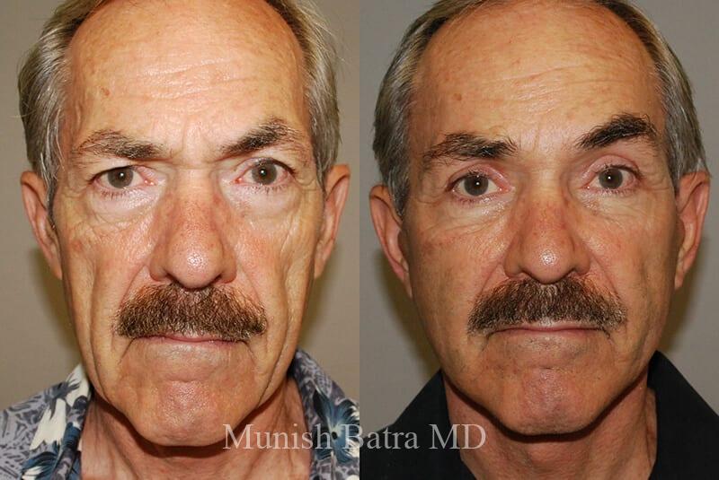 Before and After Image