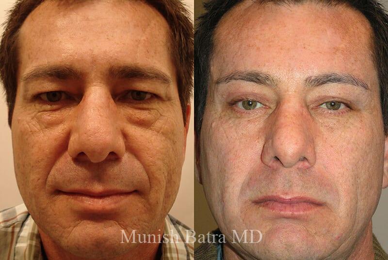Before and After Image