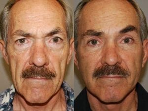Before and After Image