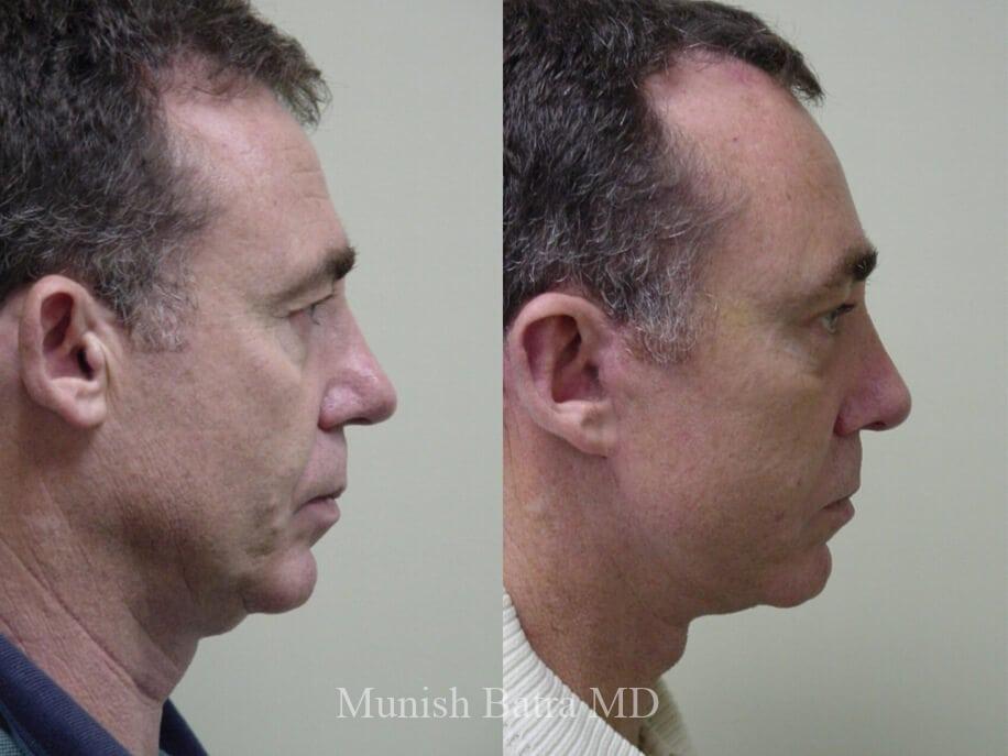 Before and After Image