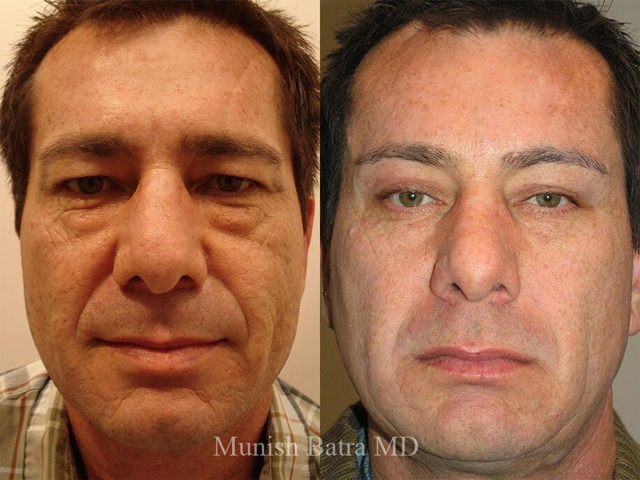 Before and After Image