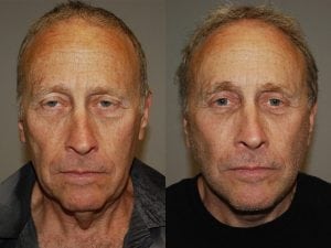 Before and After Image