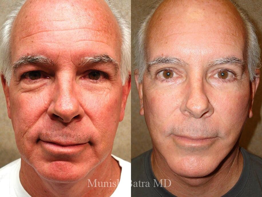 Before and After Image