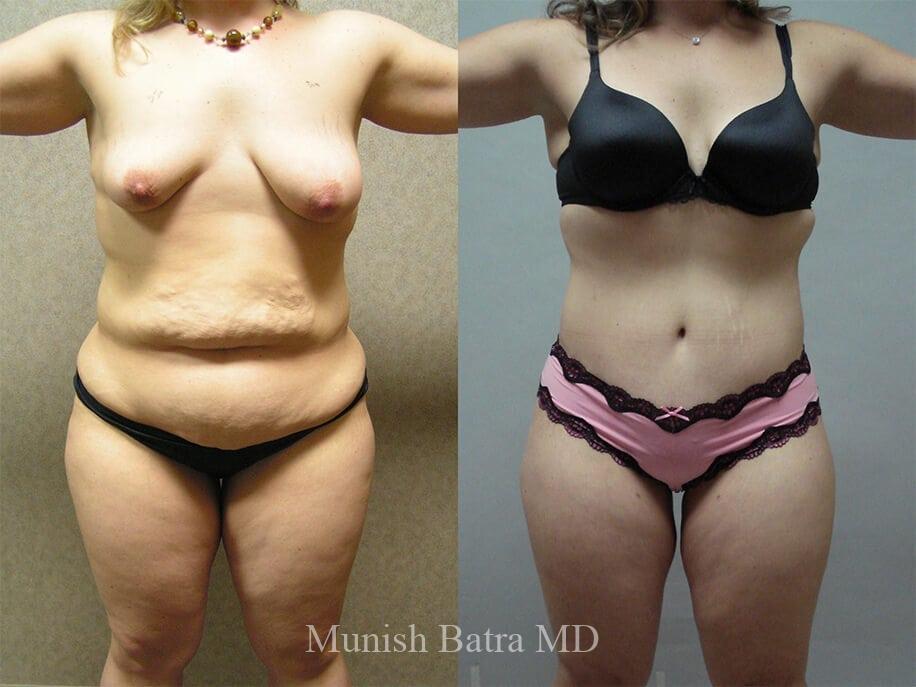 Before and After Image