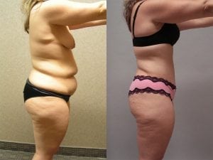 Before and After Image