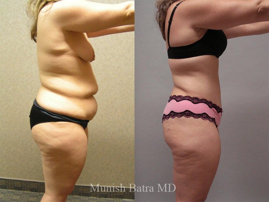 Before and After Image