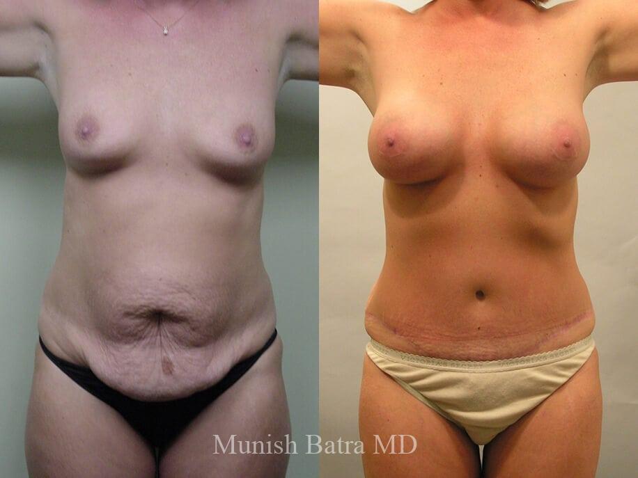 Before and After Image