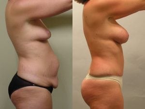 Before and After Image